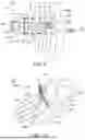 Fig. 06 - INSTRUMENTS AND SURGICAL METHODS FOR BUNION PROCEDURES