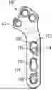 Fig. 01 - OFFSET HOLE FOR TPLO COMPRESSION