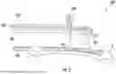 Fig. 03 - TARGETING SYSTEM FOR A PERIPROSTHETIC BONE PLATE