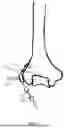 Fig. 03 - SYSTEMS FOR SURGICAL TREATMENT OF THE ELBOW