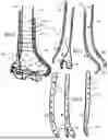 Fig. 06 - SYSTEMS FOR SURGICAL TREATMENT OF THE ELBOW