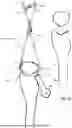 Fig. 08 - SYSTEMS FOR SURGICAL TREATMENT OF THE ELBOW