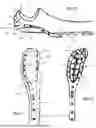 Fig. 09 - SYSTEMS FOR SURGICAL TREATMENT OF THE ELBOW