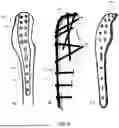Fig. 10 - SYSTEMS FOR SURGICAL TREATMENT OF THE ELBOW