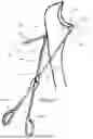 Fig. 12 - SYSTEMS FOR SURGICAL TREATMENT OF THE ELBOW