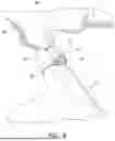 Fig. 04 - SURGICAL ASSISTANCE DEVICE