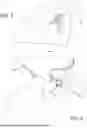 Fig. 05 - SURGICAL ASSISTANCE DEVICE