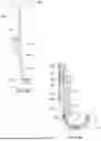 Fig. 11 - Implant Removal Instrument