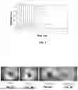 Fig. 02 - METHODS AND APPARATUSES FOR TARGETED TUMOR-SPECIFIC ABLATION