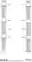Fig. 04 - Catheter Electrode Assemblies and Methods of Construction Thereof
