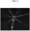 Fig. 06 - DEVICES AND METHODS FOR DELIVERING FLUID TO TISSUE DURING ABLATION THERAPY