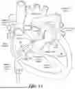 Fig. 05 - TIMED ENERGY DELIVERY