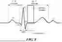 Fig. 10 - TIMED ENERGY DELIVERY
