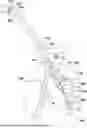 Fig. 01 - DEVICES AND METHODS FOR TREATING LUNG TUMORS