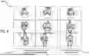 Fig. 10 - AUTOMATED SEGMENTATION FOR ACL REVISION OPERATIVE PLANNING