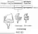 Fig. 16 - METHODS FOR IMPROVED SURGICAL PLANNING USING MACHINE LEARNING AND DEVICES THEREOF