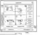 Fig. 30 - METHODS FOR IMPROVED SURGICAL PLANNING USING MACHINE LEARNING AND DEVICES THEREOF
