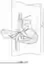 Fig. 33 - METHODS FOR IMPROVED SURGICAL PLANNING USING MACHINE LEARNING AND DEVICES THEREOF