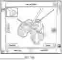 Fig. 42 - METHODS FOR IMPROVED SURGICAL PLANNING USING MACHINE LEARNING AND DEVICES THEREOF