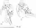 Fig. 47 - METHODS FOR IMPROVED SURGICAL PLANNING USING MACHINE LEARNING AND DEVICES THEREOF