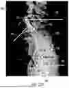 Fig. 48 - METHODS FOR IMPROVED SURGICAL PLANNING USING MACHINE LEARNING AND DEVICES THEREOF