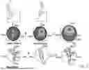 Fig. 56 - METHODS FOR IMPROVED SURGICAL PLANNING USING MACHINE LEARNING AND DEVICES THEREOF