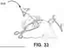 Fig. 62 - METHODS FOR IMPROVED SURGICAL PLANNING USING MACHINE LEARNING AND DEVICES THEREOF