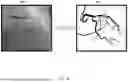 Fig. 03 - AUGMENTED REALITY DISPLAY OF SURGICAL IMAGING
