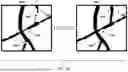 Fig. 13 - AUGMENTED REALITY DISPLAY OF SURGICAL IMAGING