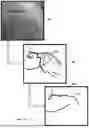 Fig. 15 - AUGMENTED REALITY DISPLAY OF SURGICAL IMAGING