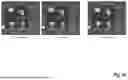 Fig. 09 - PATIENT-SPECIFIC SURGICAL METHOD AND SYSTEM
