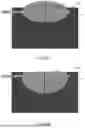Fig. 11 - SYSTEMS AND METHODS FOR ADAPTIVE ABLATION VOLUME PREDICTION BASED ON TISSUE TEMPERATURE MEASUREMENTS AND ANATOMICAL SEGMENTATION