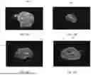 Fig. 13 - SYSTEMS AND METHODS FOR ADAPTIVE ABLATION VOLUME PREDICTION BASED ON TISSUE TEMPERATURE MEASUREMENTS AND ANATOMICAL SEGMENTATION