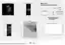 Fig. 15 - SYSTEMS AND METHODS FOR ADAPTIVE ABLATION VOLUME PREDICTION BASED ON TISSUE TEMPERATURE MEASUREMENTS AND ANATOMICAL SEGMENTATION