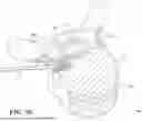 Fig. 17 - Techniques For Reducing Latency During Tracking A Handheld Surgical Instrument Using Mesh To Mesh Collisions And A Modified End Effector Model