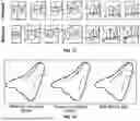 Fig. 14 - Coordinate System Prediction in Digital Dentistry and Digital Orthodontics, and the Validation of that Prediction