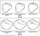 Fig. 15 - Coordinate System Prediction in Digital Dentistry and Digital Orthodontics, and the Validation of that Prediction