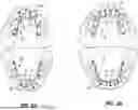 Fig. 05 - DENTAL APPLIANCES AND ASSOCIATED METHODS OF MANUFACTURING