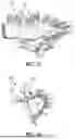Fig. 17 - DENTAL APPLIANCES AND ASSOCIATED METHODS OF MANUFACTURING
