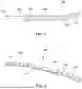 Fig. 03 - ORTHODONTIC APPARATUS