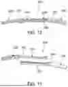 Fig. 07 - ORTHODONTIC APPARATUS
