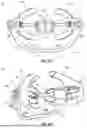 Fig. 13 - DENTAL RETRACTOR CONFIGURED FOR CONTINUOUS FLUID REMOVAL
