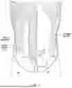 Fig. 04 - ARTIFICIAL BLADDER