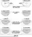 Fig. 03 - BREAST IMPLANTS WITH INTEGRATED TRANSPONDERS