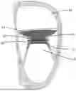 Fig. 01 - PROSTHETIC HEART VALVE DELIVERY SYSTEM AND METHOD