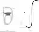 Fig. 02 - PROSTHETIC HEART VALVE DELIVERY SYSTEM AND METHOD