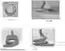 Fig. 14 - PROSTHETIC HEART VALVE DELIVERY SYSTEM AND METHOD