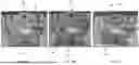 Fig. 17 - PROSTHETIC HEART VALVE DELIVERY SYSTEM AND METHOD