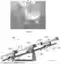 Fig. 33 - PROSTHETIC HEART VALVE DELIVERY SYSTEM AND METHOD