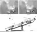 Fig. 40 - PROSTHETIC HEART VALVE DELIVERY SYSTEM AND METHOD